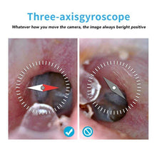 Load image into Gallery viewer, Ear Wax Removal Tool With Microscope - Eternimo
