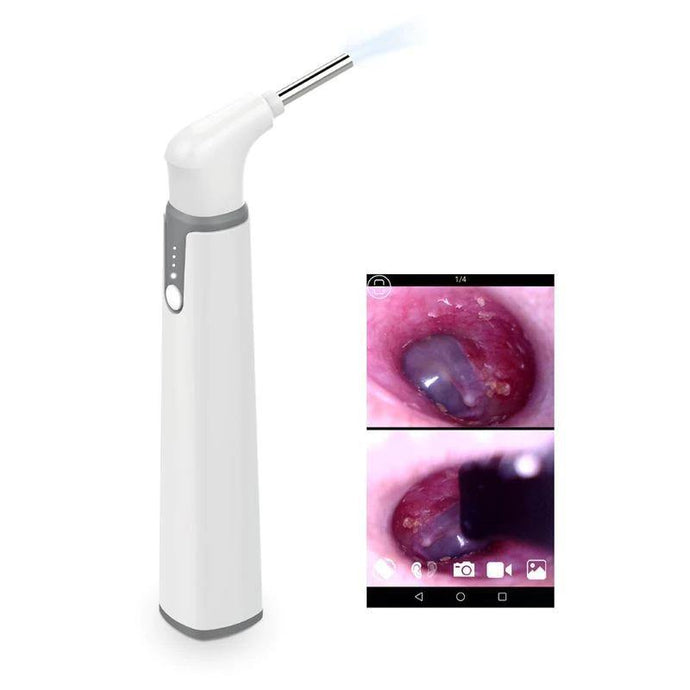 Ear Wax Removal Tool With Microscope - Eternimo